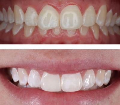 Children's Dentistry