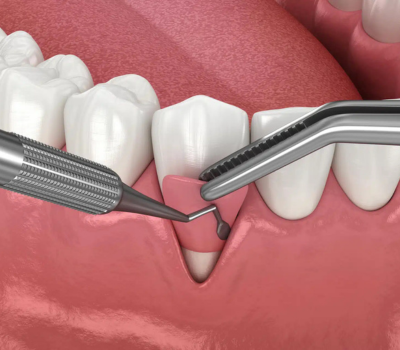 Children's Dentistry